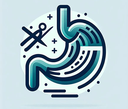 Gastric Sleeve Surgery