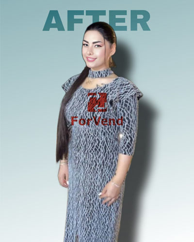 بعد از جراحی چاقی 1