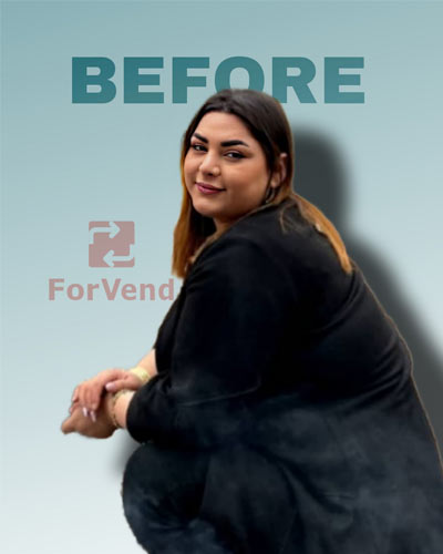 قبل از جراحی چاقی 1